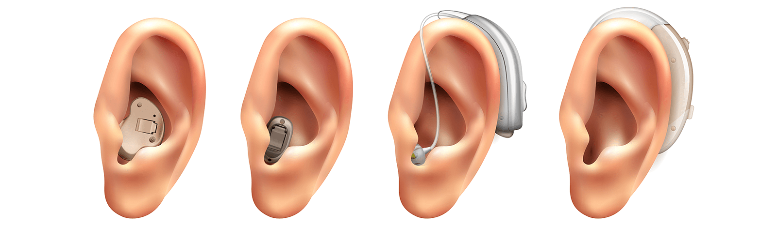 Hearing Aids for Tinnitus Relief